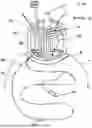 Fig. 04 - Isolated pressurization system and bag configuration
