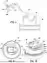 Fig. 06 - Dispenser, Method and Cleaning System for Engine Valves