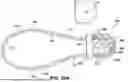 Fig. 33 - DEVICES AND METHODS RELATED TO MEDICAL TUBES
