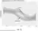 Fig. 11 - SEPARATOR SYSTEM FOR USE IN AGRICULTURAL PROCESSING