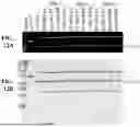 Fig. 17 - INTEIN SYSTEMS AND USES THEREOF