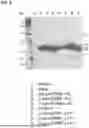 Fig. 09 - Modification and Compositions of Human Secretoglobin Proteins