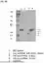 Fig. 11 - Modification and Compositions of Human Secretoglobin Proteins