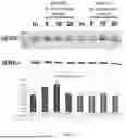 Fig. 04 - PROCESS FOR THE PRODUCTION OF IRISIN, ITS FORMULATIONS AND ITS ADMINISTRATION ROUTES