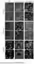 Fig. 17 - Preventative Agent or Therapeutic Agent for Amyotrophic Lateral Sclerosis, Parkinson's Disease, Huntington's Disease, Spinocerebellar Ataxia, Aging-Related Degenerative or Neurological Disease, Brain Aging, or Diseases Associated With Brain Aging