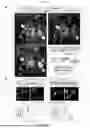 Fig. 19 - Preventative Agent or Therapeutic Agent for Amyotrophic Lateral Sclerosis, Parkinson's Disease, Huntington's Disease, Spinocerebellar Ataxia, Aging-Related Degenerative or Neurological Disease, Brain Aging, or Diseases Associated With Brain Aging