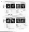 Fig. 20 - Preventative Agent or Therapeutic Agent for Amyotrophic Lateral Sclerosis, Parkinson's Disease, Huntington's Disease, Spinocerebellar Ataxia, Aging-Related Degenerative or Neurological Disease, Brain Aging, or Diseases Associated With Brain Aging