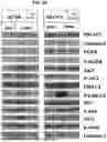 Fig. 03 - ANTIBODIES TO GALECTIN-3 AND METHODS OF USE THEREOF