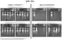 Fig. 33 - ANTIBODIES TO GALECTIN-3 AND METHODS OF USE THEREOF