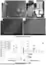 Fig. 11 - METHODS FOR THE DISPERSION PROCESSING OF HIGH ASPECT RATIO NANOMATERIALS, SUCH AS BORON NITRIDE NANOTUBES, INTO MACROSTRUCTURES