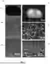 Fig. 14 - IN VITRO DEVICE FOR VASCULARIZED MICROFLUIDIC MODELING OF OSTEOCHONDRAL UNIT