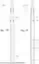 Fig. 13 - CONTINGENCY FOR SURFACE CONTROLLED GAS LIFT VALVE