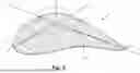 Fig. 03 - UNDUCTED THRUST-GENERATING ASSEMBLY COMPRISING AN OUTER GUIDE VANE