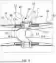 Fig. 10 - A PITCH CONTROLLED WIND TURBINE