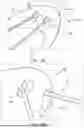 Fig. 13 - A PITCH CONTROLLED WIND TURBINE