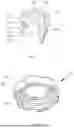 Fig. 07 - Valve Device and Pressure Balancing Assembly
