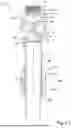 Fig. 10 - OVERFILL PREVENTION VALVE