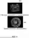 Fig. 06 - FLUORESCENCE IMAGING OF GEMSTONE ON TRANSPARENT STAGE