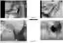 Fig. 13 - SYSTEMS, METHODS, AND APPARATUSES FOR CHARACTERIZING RELEASE PROFILES FOR LONG-ACTING INJECTABLE MEDICATIONS