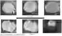 Fig. 14 - SYSTEMS, METHODS, AND APPARATUSES FOR CHARACTERIZING RELEASE PROFILES FOR LONG-ACTING INJECTABLE MEDICATIONS