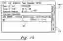 Fig. 10 - SYSTEM FOR ANALYZING PLATELET RICH PLASMA