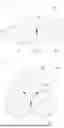 Fig. 08 - NANOPARTICLE BODY, COMPOSITE CONTAINING NANOPARTICLE BODIES, AND METHOD FOR FORMING POLYMER MEMBRANE CONTAINING NANOPARTICLE BODY