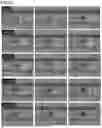 Fig. 10 - KIT FOR DETECTING GLYCOPROTEIN
