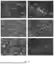Fig. 12 - MULTIPLEX IMMUNOBLOT EARLY CANCER DIAGNOSTICS TEST FOR VETERINARY DIAGNOSTICS