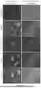Fig. 14 - IDENTIFICATION OF TDP-43 CRYPTIC EXON-ENCODED NEOEPITOPES AS FUNCTIONAL FLUID BIOMARKERS FOR ALZHEIMER'S DISEASE AND RELATED DEMENTIA