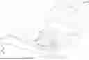 Fig. 03 - SENSOR LENS ASSEMBLY AND HOUSING THEREOF