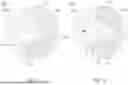 Fig. 05 - IMAGING LENS ASSEMBLY AND ELECTRONIC DEVICE