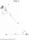 Fig. 08 - BINOCULAR LOUPES AND METHODS OF MANUFACTURING BINOCULAR LOUPES