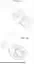 Fig. 11 - BINOCULAR LOUPES AND METHODS OF MANUFACTURING BINOCULAR LOUPES