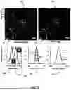 Fig. 12 - DEVICE AND METHOD FOR CALIBRATION-FREE PHASE SHIFTING PROCEDURE FOR SELF-INTERFERENCE HOLOGRAPHY