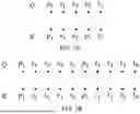 Fig. 08 - ATTENTION MASK FOR SIMULTANEOUS TRANSLATION WITH POSITIONAL REORDERING