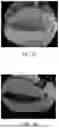 Fig. 05 - GENERATING TOP VIEW OF VEHICLE WITH IMAGE HARMONIZATION BASED ON CAMERA ORIENTATION