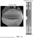 Fig. 06 - GENERATING TOP VIEW OF VEHICLE WITH IMAGE HARMONIZATION BASED ON CAMERA ORIENTATION
