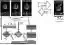 Fig. 01 - METHODS AND SYSTEMS FOR AUTO-QUANTIFICATION OF ULTRASOUND IMAGES DURING LIVE SCAN