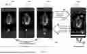 Fig. 04 - METHODS AND SYSTEMS FOR AUTO-QUANTIFICATION OF ULTRASOUND IMAGES DURING LIVE SCAN