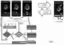 Fig. 05 - METHODS AND SYSTEMS FOR AUTO-QUANTIFICATION OF ULTRASOUND IMAGES DURING LIVE SCAN
