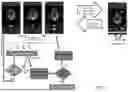 Fig. 06 - METHODS AND SYSTEMS FOR AUTO-QUANTIFICATION OF ULTRASOUND IMAGES DURING LIVE SCAN