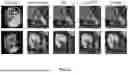 Fig. 13 - APPARATUS AND METHOD FOR SEGMENTATION OF MEDICAL IMAGE