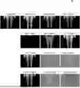 Fig. 01 - Systems and Methods for Quantifying Skin Pigmentation Conditions