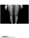 Fig. 04 - Systems and Methods for Quantifying Skin Pigmentation Conditions