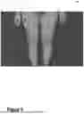 Fig. 06 - Systems and Methods for Quantifying Skin Pigmentation Conditions