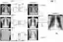 Fig. 05 - TECHNIQUE FOR ANOMALY DETECTION IN MEDICAL IMAGES