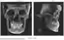 Fig. 06 - METHOD FOR GENERATING DENTAL REGISTRATION DATA