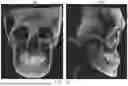 Fig. 10 - METHOD FOR GENERATING DENTAL REGISTRATION DATA