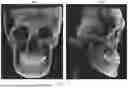 Fig. 11 - METHOD FOR GENERATING DENTAL REGISTRATION DATA