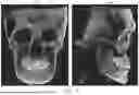 Fig. 12 - METHOD FOR GENERATING DENTAL REGISTRATION DATA